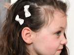 Barrettes clic-clac petits noeuds  blanc pailleté